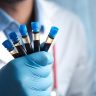 Understanding the Basics of Hematology