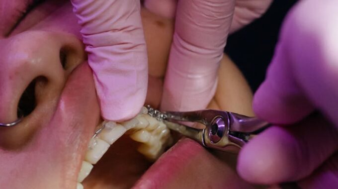 The Journey to a Healthier Smile: What to Know About Oral Surgery