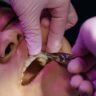 The Journey to a Healthier Smile: What to Know About Oral Surgery