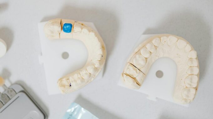 The Basic Guide to Dental Crowns: Benefits, Types, and Costs